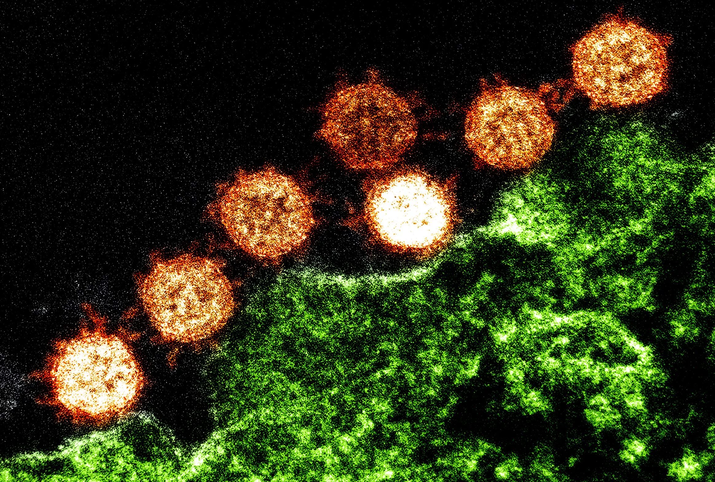 Virus. SARS-cov-2 под электронным микроскопом. Коронавирус SARS cov 2 под микроскопом. Coronavirus микроскоп. Коронавирус 1920 1080.