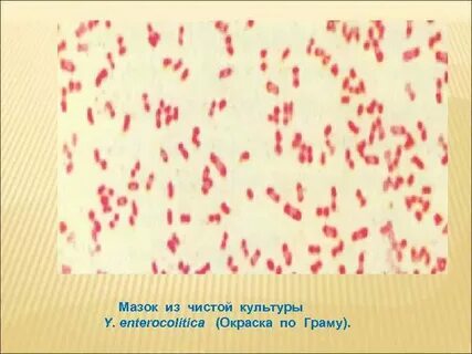 Сальмонелла мазок