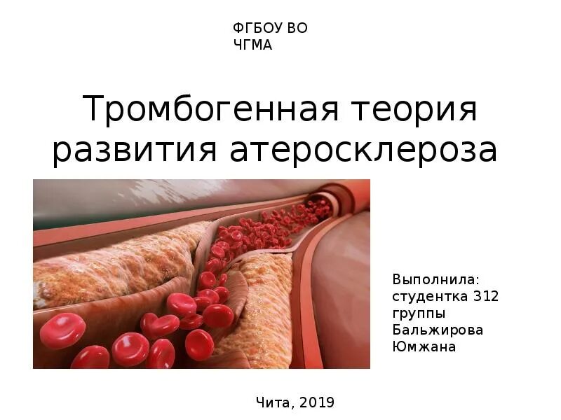 Атеросклероз курсовая работа. Тромбогенная теория рокитанского-дьюгеда:. тромбогенная теория атеросклероза. тромбогенная теория развития атеросклероза. атеросклероз презентация.