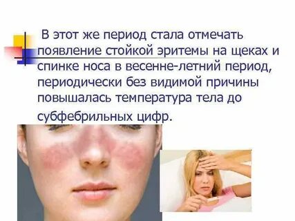 Продолжительность физиологической эритемы