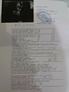 Узи сердца нижний