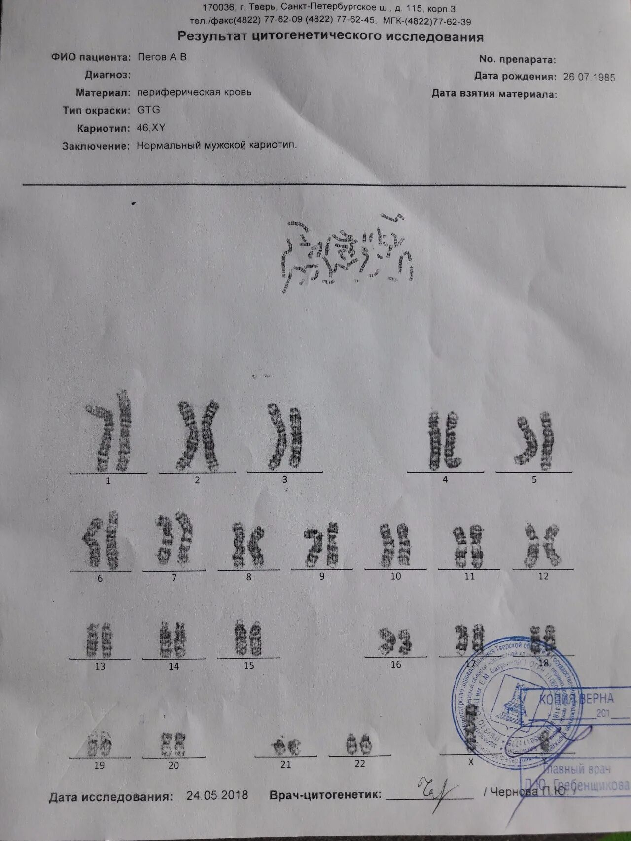Кариотипирование супругов цена. Анализ кариотип трисомия заключение. Кариотипирование анализ. Кариотипирование заключение. Заключение нормальный мужской кариотип что это.