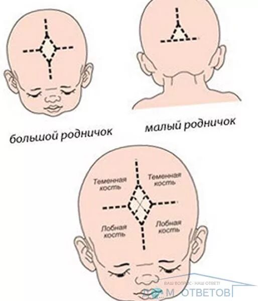 Температура родничок. Темечко у новорожденных норма. Родничок у ребенка 2 года норма. Западение родничка у новорожденного. Форма большого родничка у новорожденного.