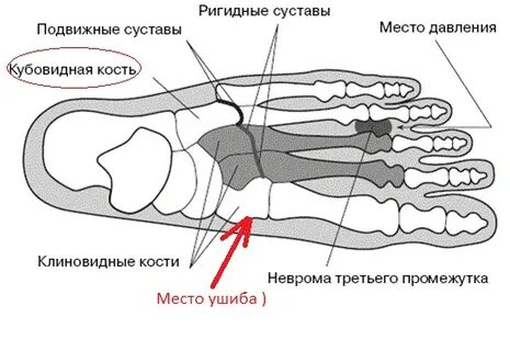 Боли в костях стопы лечение