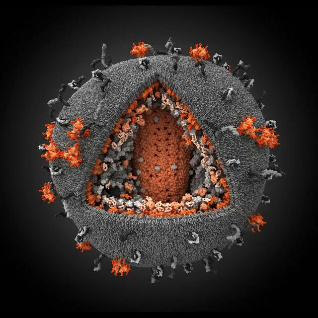 Human immunodeficiency. Вирус ВИЧ под микроскопом. Вирус иммунодефицита человека электронный микроскоп. Вирус иммунодефицита под микроскопом. Вирус иммунодефицита (ВИЧ).