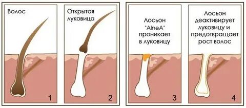 Могут ли волосяные луковицы