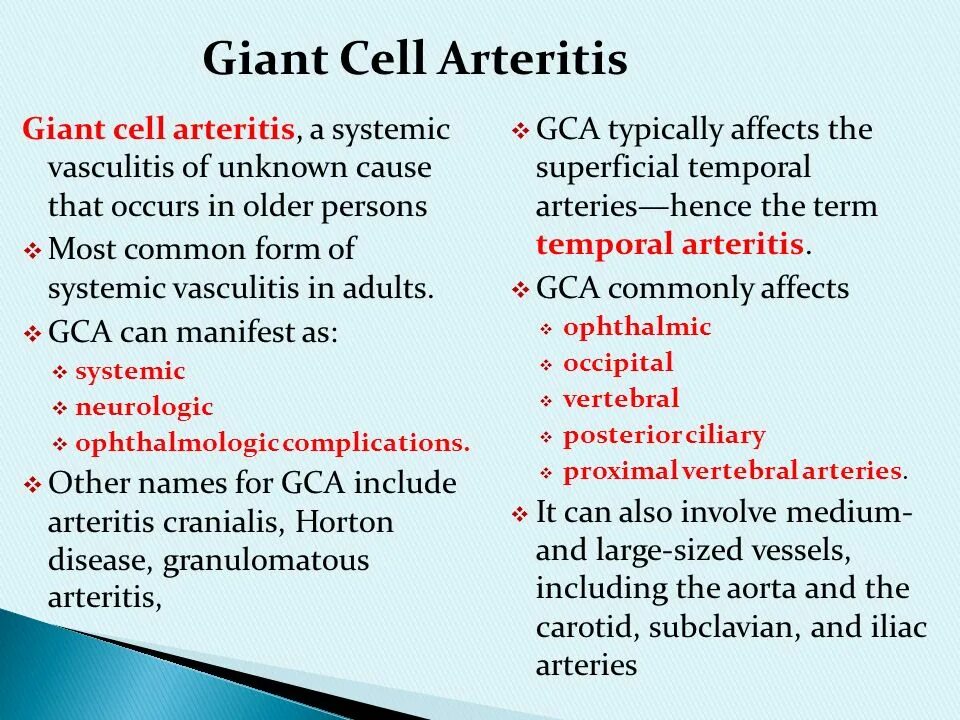 Common form. Systemic Vasculitis. Vasculitis classification.