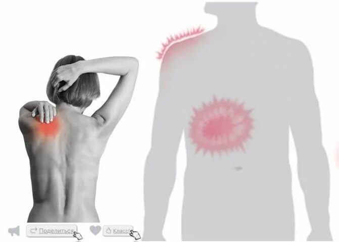 При вдохе отдает в левую. Боль в спине. Болит левая лопатка. Боль под лопаткой. ООТ лит под левой лопаткой.