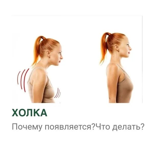 Почему появляется горбик. Вдовий горбик холка 7 шейный позвонок.