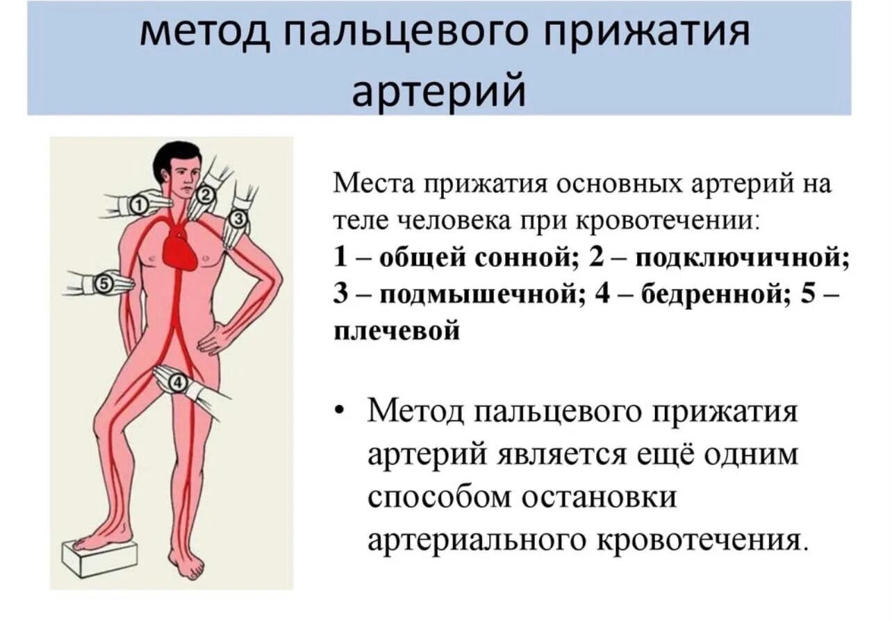 Способы остановки кровотечения пальцевое прижатие артерии. Прижатие метод остановки кровотечения. Остановка кровотечения пальцевое прижатие. Способы остановки кровотечения пальцевое прижатие артерий. Места остановки кровотечения пальцевым прижатием.