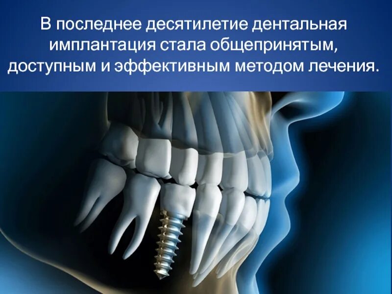 Использованные импланты