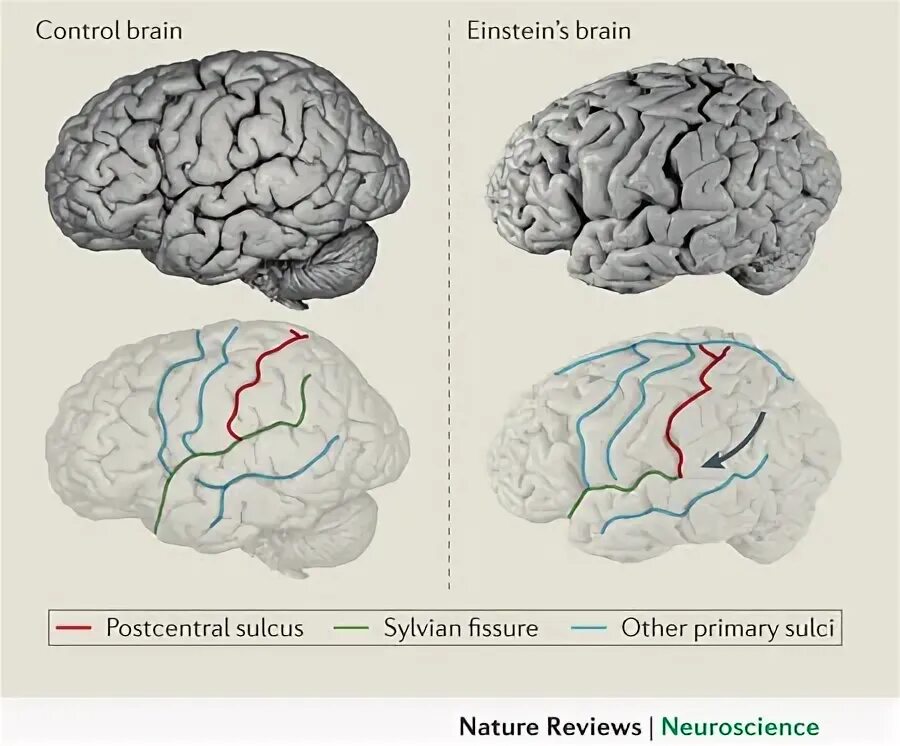 Brain vs brain. Мозг Эйнштейна. Мозг Эйнштейна после смерти. Мозг Эйнштейна и обычного человека.