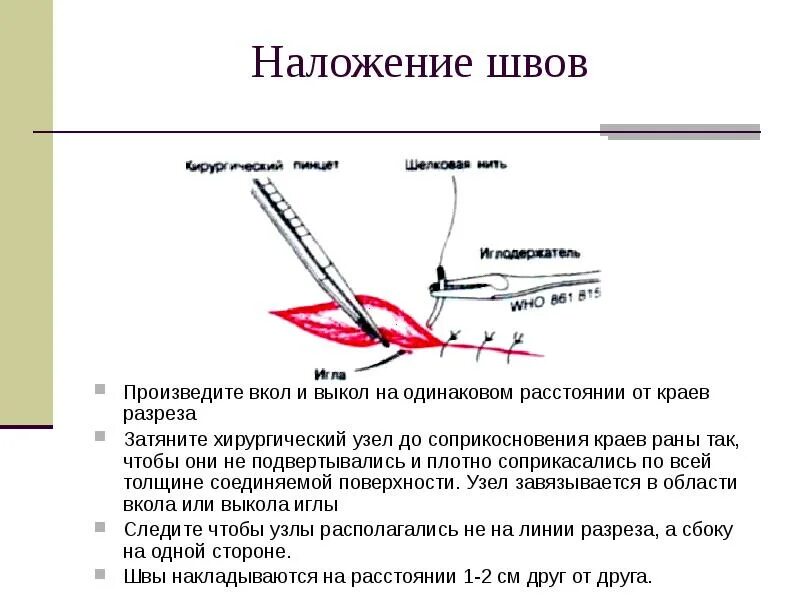 Вкол иглы