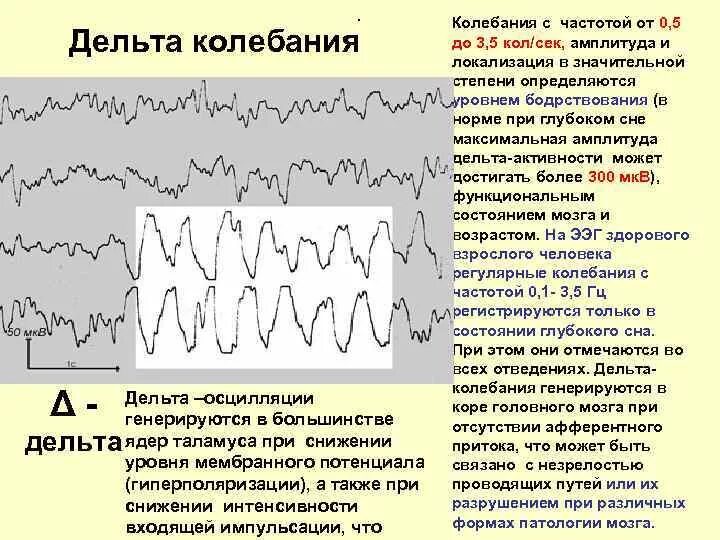 Альфа ритм мозга ЭЭГ. Дельта активность на ЭЭГ. Дельта ритм ЭЭГ. Частота ритмов ЭЭГ.