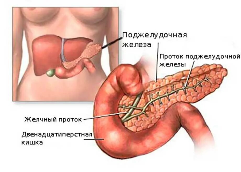 Фибролипоматоз поджелудочной железы что это. Поджелудочная симптомы заболевания у женщин. Панкреонекроз поджелудочной железы.