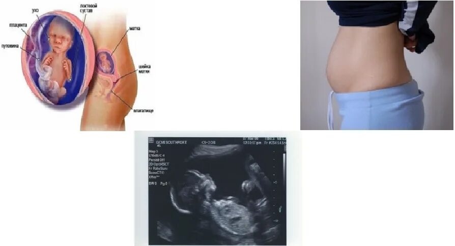 17 неделя беременности что есть. Как лежит плод в 17 недель. Положение плода 17 недель. Размер младенца в 17 недель беременности. Размеры ребенка 17 неделе как выглядит.