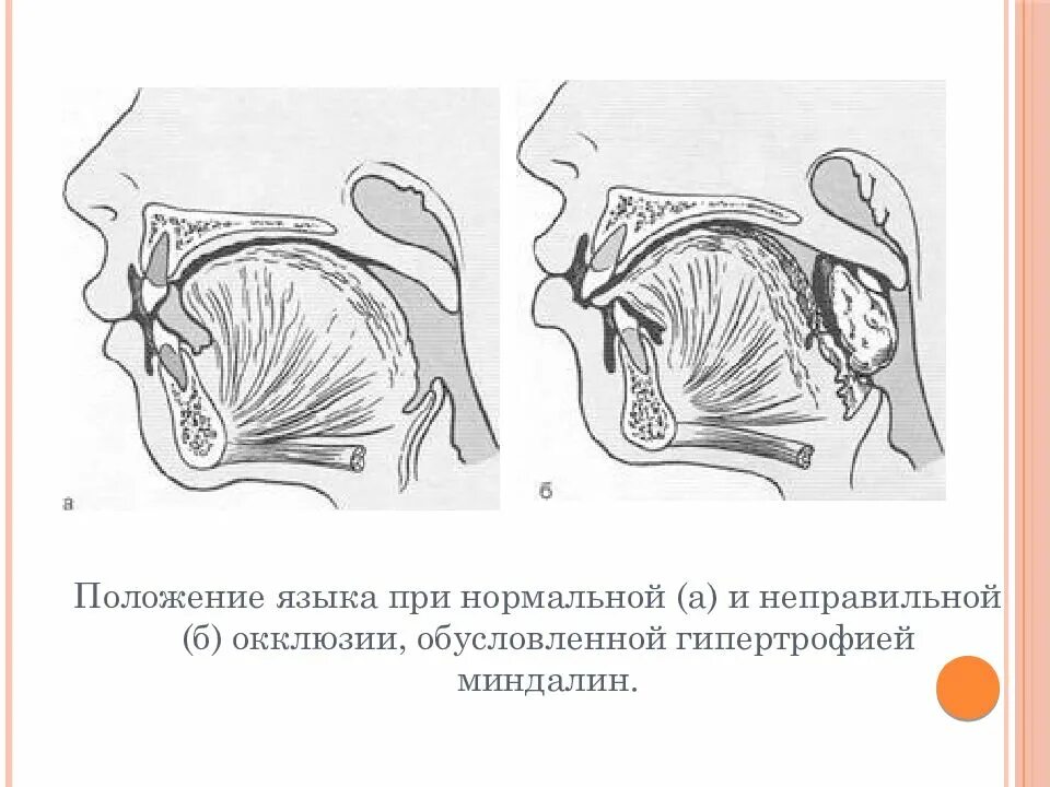 Как держать язык во рту. Правильное положение языка. Положение языка в ротовой полости.