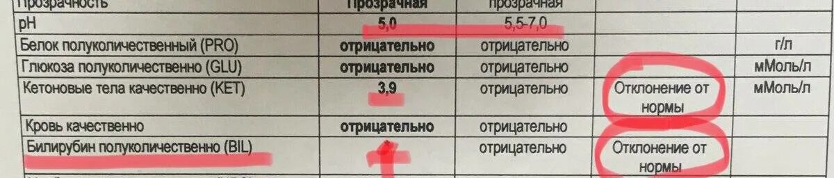 Кетоновый белок в моче. Ацетон в моче показатели нормы. Кетоновые тела в крови анализ. Кетоновые тела в моче показатели. Показатели кетоновых тел в моче, крови норма.