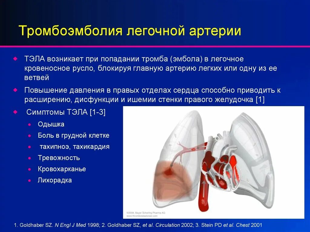 Что такое тромбоэмболия легочной артерии простыми словами. Эмболия легочной артерии симптомы. Патогенез тромбоэмболия ветвей легочной артерии. Тромбоэмболия легочной артерии клиника. При тромбоэмболии легочной артерии развивается.