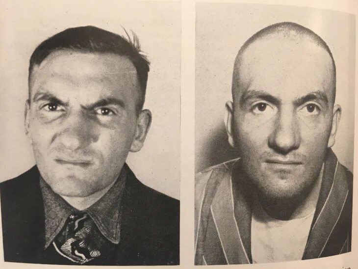 Лоботамия