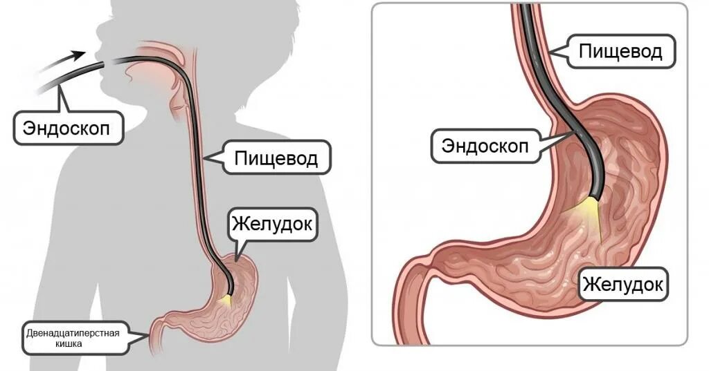 Осмотр пищевода