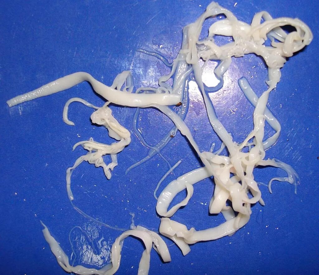 Солитер червь ленточный. Ленточные черви немертина. Длинные паразиты человека. Длинные паразиты человека. Ленточные черви бычий цепень.