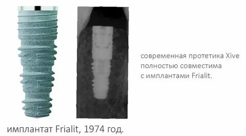 Витамины после имплантации