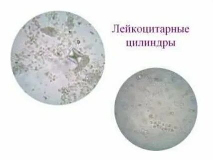 Почечный цилиндр