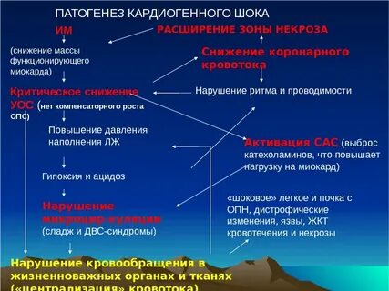 Шок при инфаркте миокарда