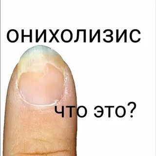 Лечение ногтевого ложе