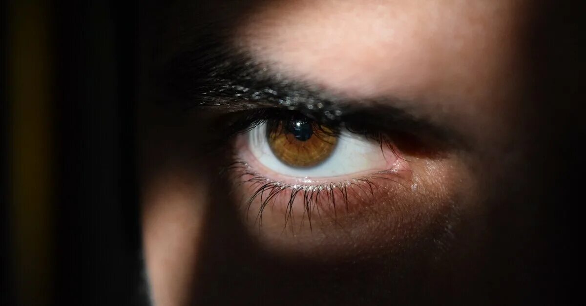 Круги под глазами. Крупно папилярный конъюнктивит. Бросил глаз. Мужской глаз в профиль. Глазной протез argus 2.