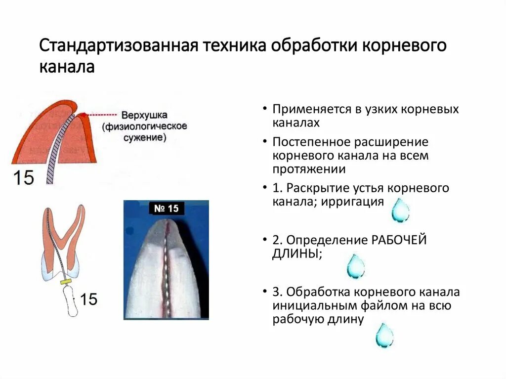 Обработка и пломбирование корневых каналов. Этапы обработки корневых каналов. Стандартизованная техника обработки корневого канала. Стандартная техника обработки корневых каналов. Методики инструментальной обработки системы корневых каналов..