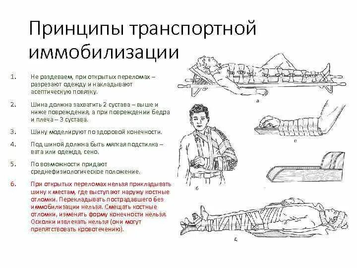 Д3 при переломах. Основное правило иммобилизации при переломах костей конечностей.. Метод иммобилизации при переломе костей конечностей. Памятка первая помощь при переломах переноска пострадавших. Транспортная иммобилизация типы шин.