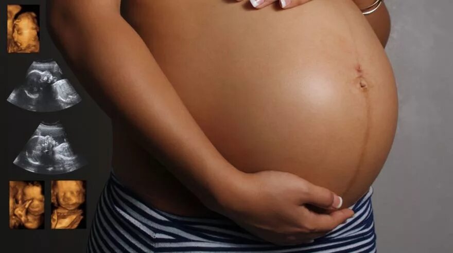 Пять детей в животе. Беременный живот. Пять детей в животе. Пять детей в животе. Живот беременной на 6 месяце.