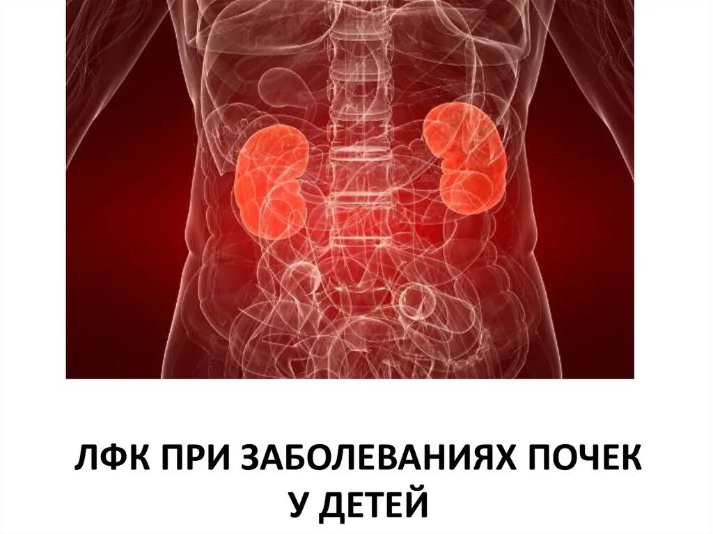 Образования почек у детей. Лфк при патологиях почек. лфк при заболеваниях почек и мочевыводящих путей.