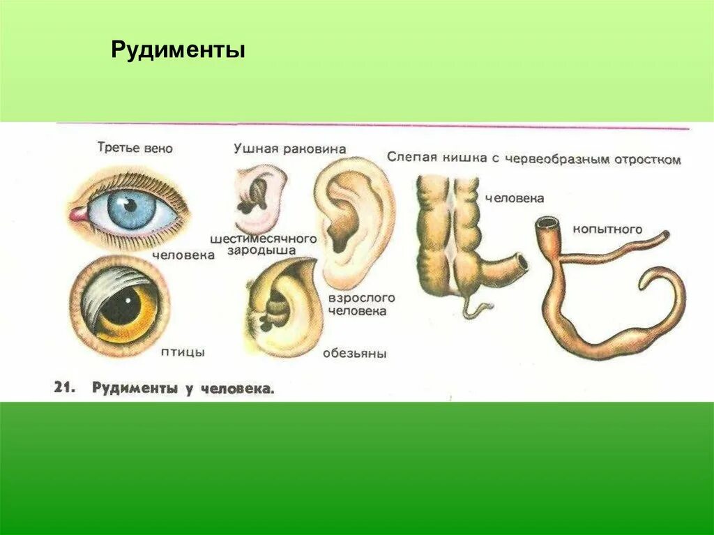 Атавизмы человека третье веко. Рудиментарные органы человека. органы рудименты у человека.