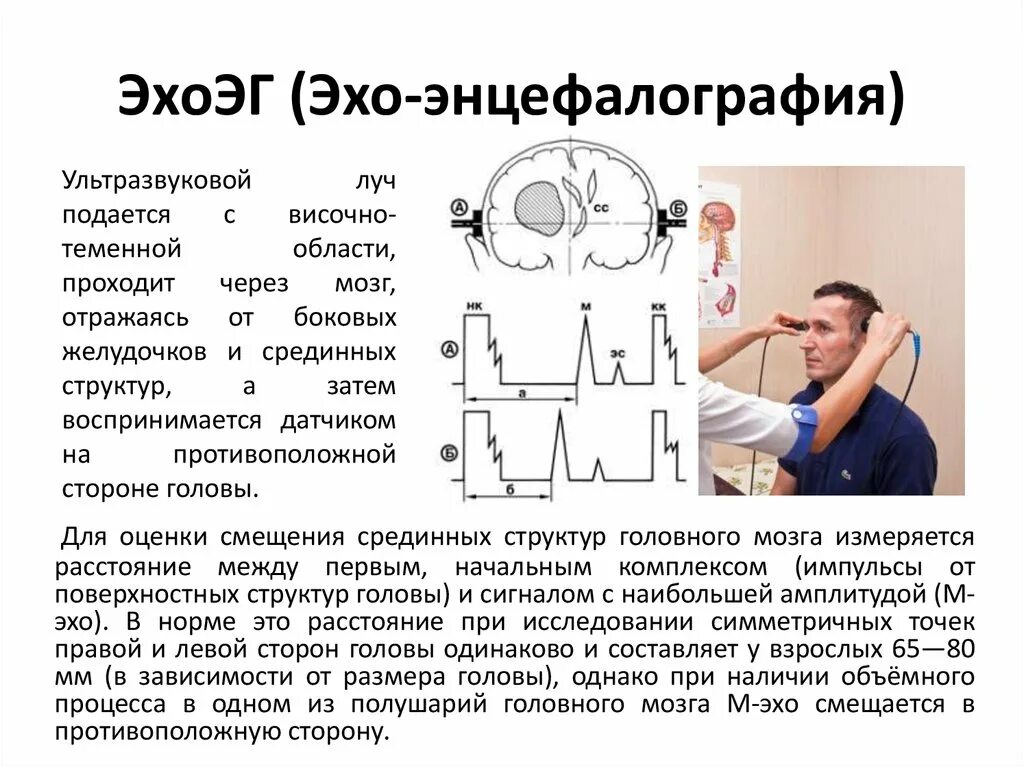 Как проходят эхо. Эхо ЭГ при геморрагическом инсульте. Эхоэнцефалография у детей показатели нормы. Эхоэнцефалоскопия принцип метода. М-Эхо головы.