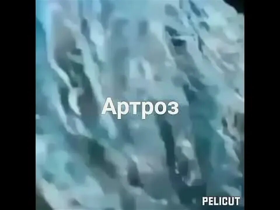 Матрица гаряева для суставов костей и мышц. Матрица гаряева для суставов костей и мышц