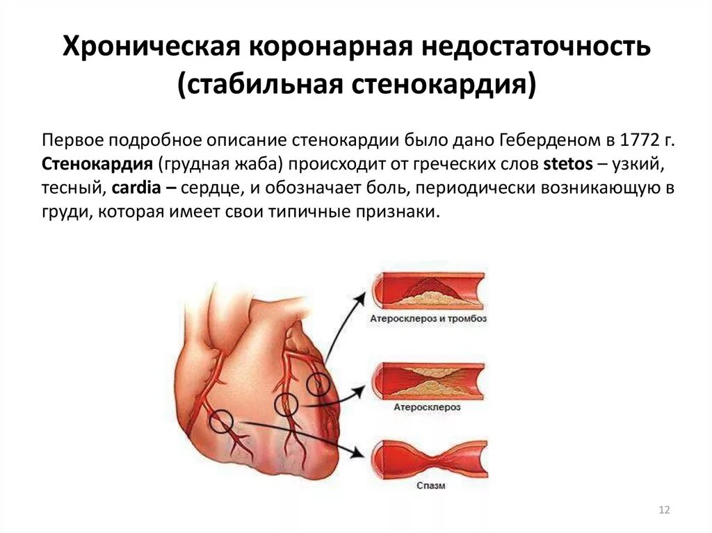 Коронарные осложнения. Острая коронарная недостаточность симптомы. Синдром острой коронарной недостаточности симптомы. Синдром хронической коронарной недостаточности. Факторы острой недостаточности коронарного кровообращения:.