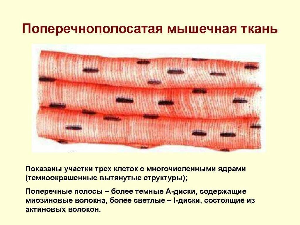 Отличие гладкой и поперечно полосатой ткани. Поперечно-полосатая Скелетная мышечная ткань. Поперечнополосатая Скелетная мышечная ткань. Поперечнополосатая мышечная ткань скелетных мышц. Что образует Скелетная поперечно полосатая мышечная ткань.