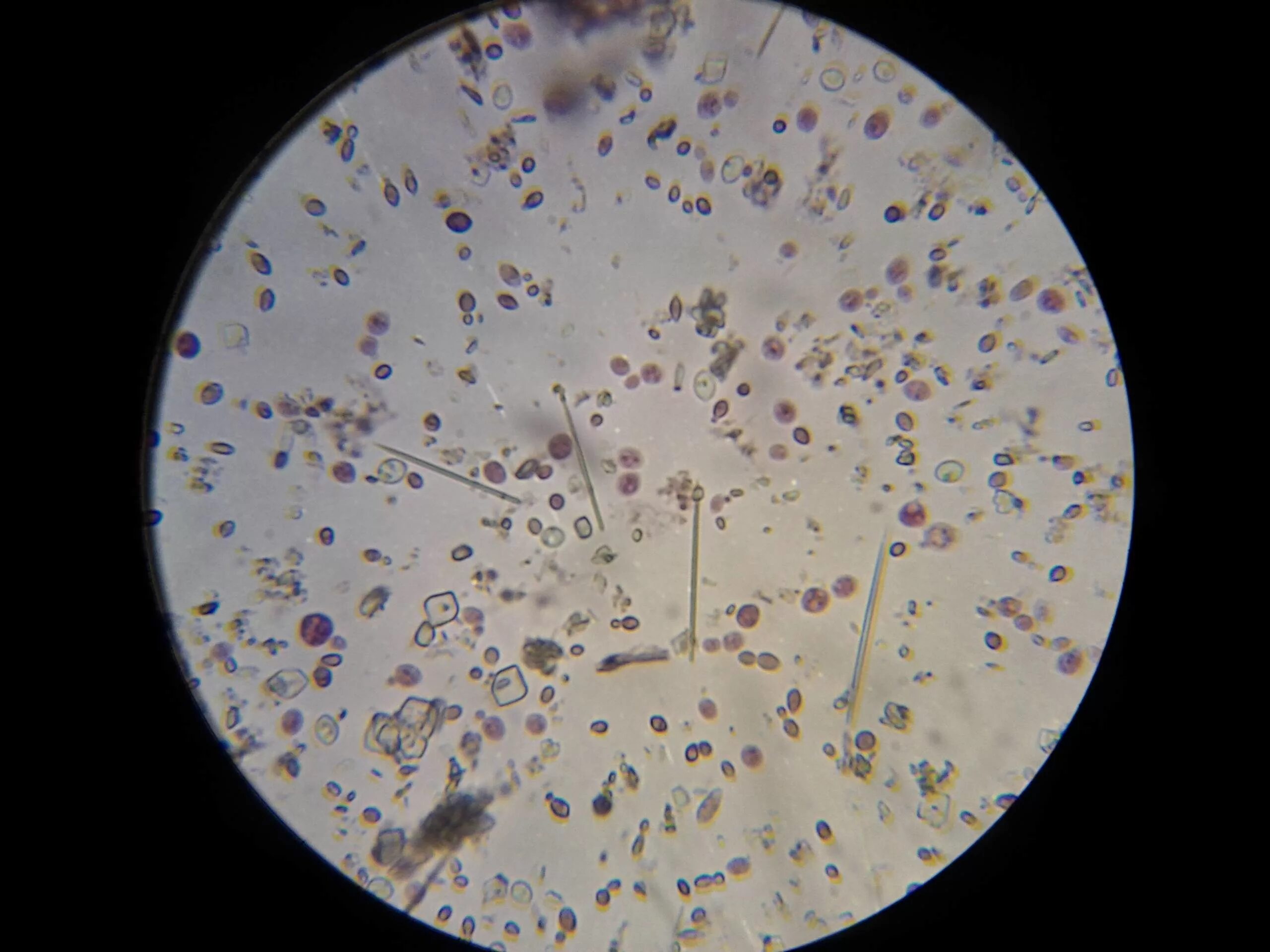 Ураты микроскопия. Микроскопия мочи бактерии. Нечипоренко микроскопия. Микроскопия осадка мочи бактерии.