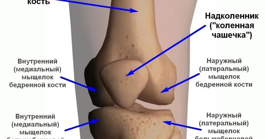 Мыщелки колена. Трабекулярный отек бедренной кости. Мыщелки коленного сустава. Мыщелок бедренной кости. Наружный мыщелок большеберцовой.