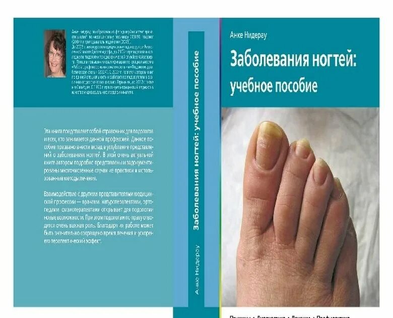Норберт шольц подология. Подология педикюр. Подолог маникюр. Атлас подология. Норберт шольц подология.