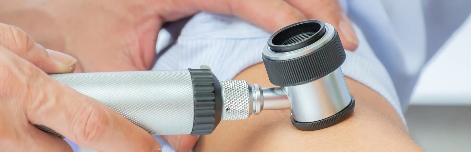 Прием онкодерматолога. Обследование дерматоскопом. Осмотр дерматовенеролога. Осмотр дерматолога. Дерматоскопия новообразований кожи.