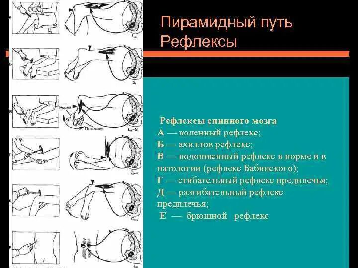 Рефлексы в норме. Ахиллов рефлекс. Ахиллов рефлекс норма и патология. Коленный Ахиллов и подошвенный рефлексы. Патологический рефлекс Россолимо.