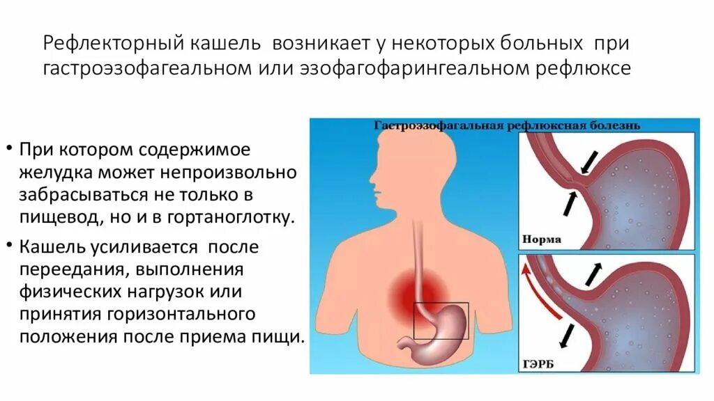 Почему кашель усиливается в положении лежа