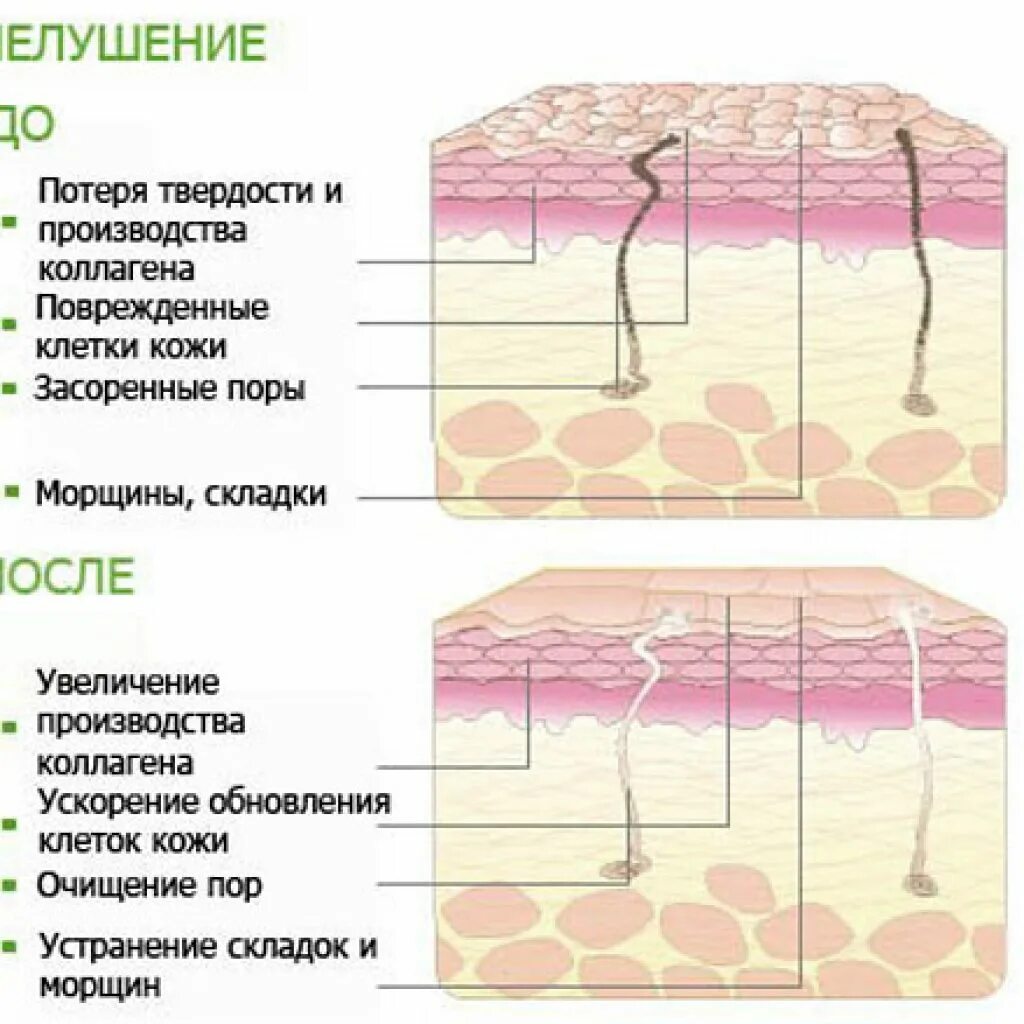 Как изменится толщина эпидермиса на солнце