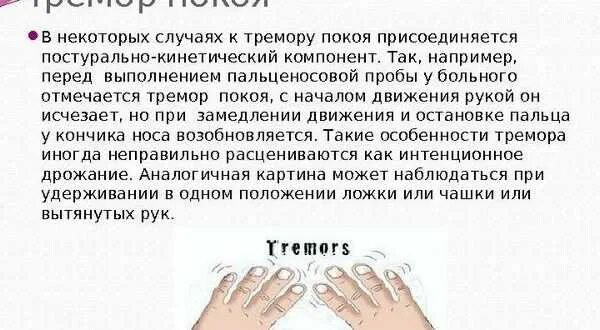 Причина тряски откуда. Тремор правой руки причины. Хлопающий тремор рук. Трясутся пальцы на руках причины.