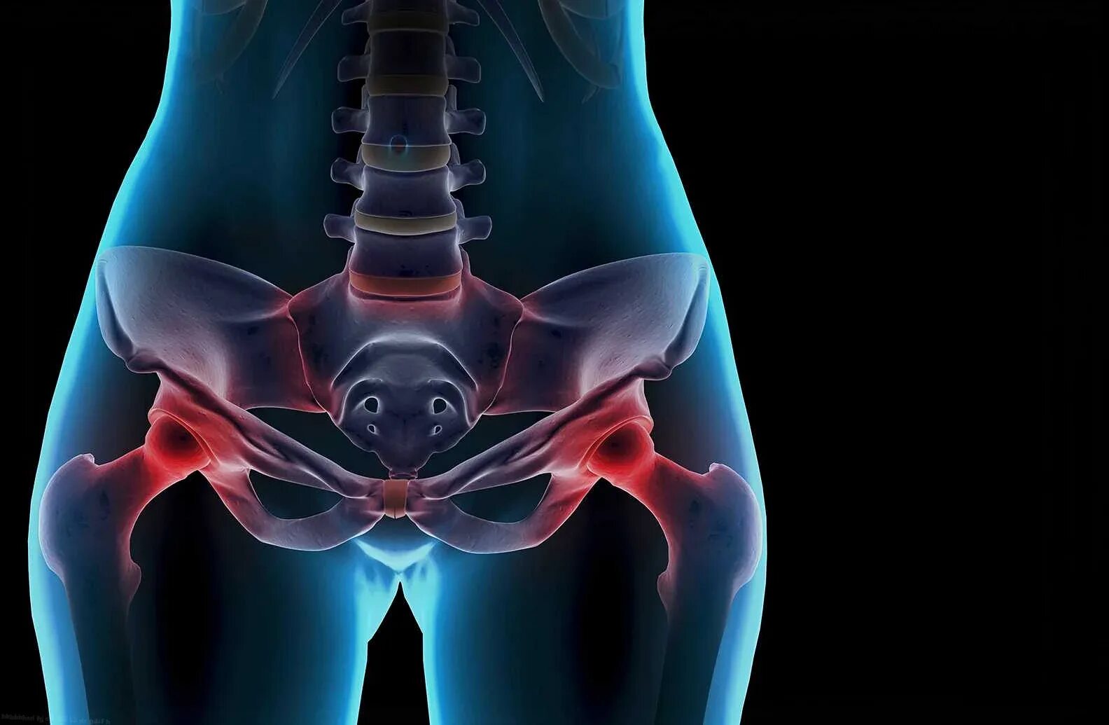 Сильные боли в тазу. Синдром хронической тазовой бол. Бурсит трохантерит тазобедренного сустава. Сильные боли в тазу. Сильные боли в тазу.