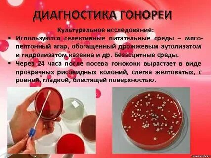 Бактериологическое исследование стафилококков
